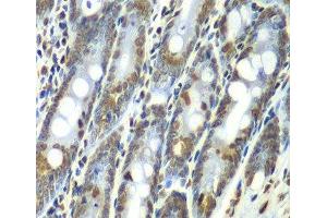 Immunohistochemistry of paraffin-embedded Rat Intestine using SEPT7 Polyclonal Antibody at dilution of 1:100 (40x lens).