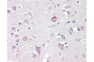 Anti-AP3B2 antibody IHC staining of human brain, cortex. (AP3B2 antibody  (N-Term))
