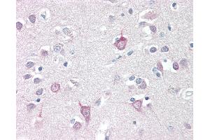 Anti-AP3B2 antibody IHC staining of human brain, cortex. (AP3B2 antibody  (N-Term))
