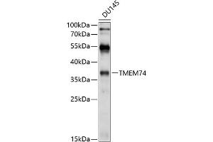 Western blot analysis of extracts of DU145 cells, using TMEM74 antibody (ABIN6131065, ABIN6149271, ABIN6149272 and ABIN6214614) at 1:1000 dilution. (TMEM74 antibody  (AA 1-180))