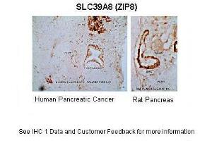 Sample Type :  Human Pancreas (Cancer) & rat pancreas   Primary Antibody Dilution :  1:150  Secondary Antibody :  Goat anti-Rabbit  Secondary Antibody Dilution :  1:300  Gene Name :  SLC39A8  Submitted by :  Anonymous (SLC39A8 antibody  (N-Term))