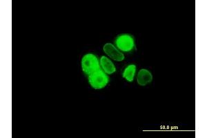 Immunofluorescence of monoclonal antibody to PGR on MCF-7 cell. (Progesterone Receptor antibody  (AA 1-110))
