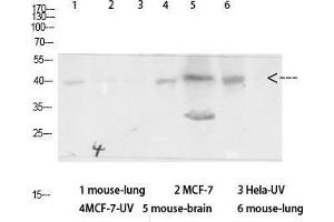 Western Blot (WB) analysis of specific cells using Antibody diluted at 1:1000. (beta Arrestin 1 antibody  (Ser157))