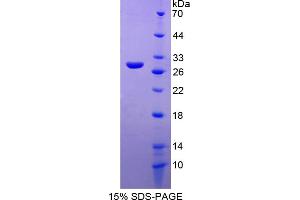 Image no. 1 for Myosin IF (MYO1F) (AA 655-922) protein (His tag) (ABIN4989830) (MYO1F Protein (AA 655-922) (His tag))