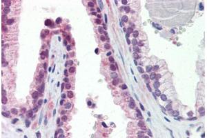 Human Prostate (formalin-fixed, paraffin-embedded) stained with TULP2 antibody ABIN462210 followed by biotinylated goat anti-rabbit IgG secondary antibody ABIN481713, alkaline phosphatase-streptavidin and chromogen. (TULP2 antibody  (N-Term))