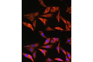 Immunofluorescence analysis of NIH/3T3 cells using ALDOB Rabbit pAb (ABIN1678634, ABIN3018008, ABIN3018009 and ABIN6220333) at dilution of 1:100. (ALDOB antibody  (AA 1-200))