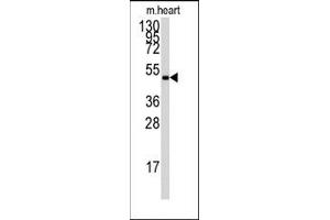 Image no. 2 for anti-Protein Kinase, AMP-Activated, gamma 1 Non-Catalytic Subunit (PRKAG1) (Middle Region) antibody (ABIN359117) (PRKAG1 antibody  (Middle Region))