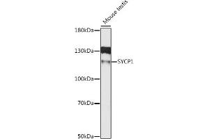 Western blot analysis of extracts of mouse testis, using SYCP1 antibody (ABIN6128702, ABIN6148758, ABIN6148759 and ABIN6215723) at 1:1000 dilution. (SYCP1 antibody  (AA 100-400))