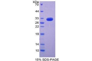 SDS-PAGE (SDS) image for Transforming Growth Factor, beta Receptor 1 (TGFBR1) (AA 162-403) protein (His tag) (ABIN2127065)