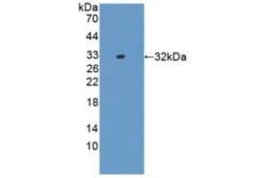 Detection of Recombinant IL17RD, Rat using Polyclonal Antibody to Interleukin 17 Receptor D (IL17RD) (IL17RD antibody  (AA 356-605))