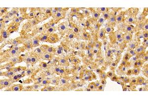 Detection of OT in Mouse Liver Tissue using Polyclonal Antibody to Preprooxytocin (OT) (OXT antibody  (AA 20-124))