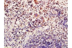 Immunohistochemistry (Paraffin-embedded Sections) (IHC (p)) image for anti-ATG16 Autophagy Related 16-Like 1 (ATG16L1) (AA 501-607) antibody (ABIN752443)
