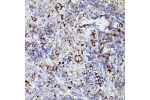 Immunohistochemistry of paraffin-embedded rat spleen using THBS1 Rabbit pAb (ABIN3022978, ABIN3022979, ABIN3022980 and ABIN6219329) at dilution of 1:50 (40x lens). (Thrombospondin 1 antibody  (AA 80-360))