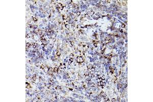 Immunohistochemistry of paraffin-embedded rat spleen using THBS1 Rabbit pAb (ABIN3022978, ABIN3022979, ABIN3022980 and ABIN6219329) at dilution of 1:50 (40x lens).