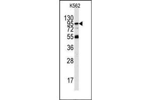 Image no. 1 for anti-Phosphoinositide-3-Kinase, Regulatory Subunit 5 (PIK3R5) (Middle Region) antibody (ABIN360464)