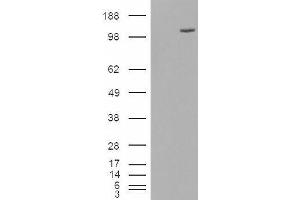 HEK293 overexpressing FAM62A (ABIN5432558) and probed with ABIN334395 (mock transfection in first lane). (ESYT1 antibody  (Internal Region))