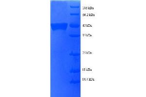 BTF3 Protein (AA 48-206, partial) (GST tag)