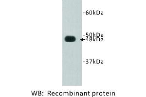 Image no. 1 for anti-FAT Tumor Suppressor Homolog 4 (FAT4) antibody (ABIN1112888) (FAT4 antibody)