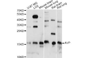 Western blot analysis of extracts of various cell lines, using AVP antibody (ABIN6291780) at 1:1000 dilution. (Vasopressin antibody)