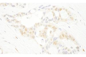 Immunohistochemistry (IHC) image for anti-Serine/threonine-Protein Kinase PRP4 Homolog (PRPF4B) (AA 1-50) antibody (ABIN7448746) (PRPF4B antibody  (AA 1-50))