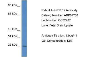 Western Blotting (WB) image for anti-Ribosomal Protein L12 (RPL12) (N-Term) antibody (ABIN786484) (RPL12 antibody  (N-Term))