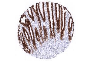 stomach antrum (Recombinant MUC5AC antibody)