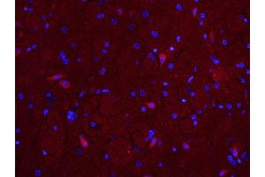 Paraformaldehyde-fixed, paraffin embedded Mouse brain; Antigen retrieval by boiling in sodium citrate buffer (pH6. (MUL1 antibody  (AA 45-95))