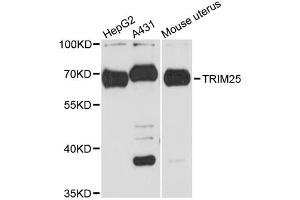 Western blot analysis of extracts of various cell lines, using TRIM25 antibody. (TRIM25 antibody)