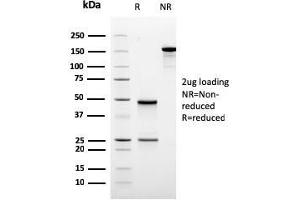 SDS-PAGE Analysis Purified ODC-1 Recombinant Mouse Monoclonal Antibody (rODC1/485). (Recombinant ODC1 antibody)