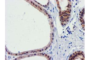 Immunohistochemical staining of paraffin-embedded Human breast tissue using anti-FBXO21 mouse monoclonal antibody. (FBXO21 antibody)