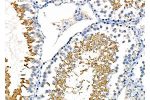 ABIN6262069 and ABIN6276964 at 1/100 staining Rat testis tissue by IHC-P.