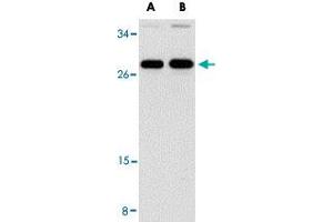 Western blot analysis of PPPDE1 in EL4 cell lysate with PPPDE1 polyclonal antibody  at (A) 1 and (B) 2 ug/mL . (PPPDE1 antibody  (C-Term))
