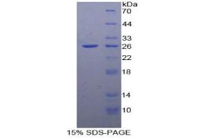 SDS-PAGE analysis of Human FADD Protein.