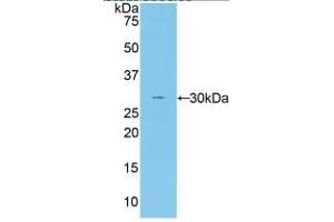 Rabbit Capture antibody from the kit in WB with Positive Control: Sample Human serum.