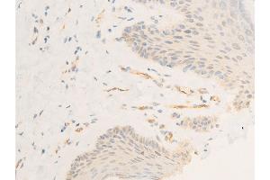 Immunohistochemistry (IHC) image for anti-Intercellular Adhesion Molecule 1 (ICAM1) (pTyr512) antibody (ABIN6255938)