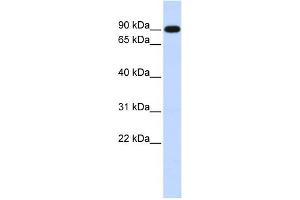 WB Suggested Anti-ZXDA Antibody Titration:  0.
