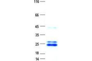 Validation with Western Blot (NADH Dehydrogenase Protein (His tag))