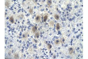 Immunohistochemistry (IHC) image for anti-Nuclear Factor of kappa Light Polypeptide Gene Enhancer in B-Cells Inhibitor, alpha (NFKBIA) (N-Term) antibody (ABIN2792665)
