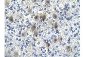 Rabbit Anti-NFKBIA antibody        Paraffin Embedded Tissue:  Human Brain cell   Cellular Data:  Epithelial cells of renal tubule  Antibody Concentration:   4. (NFKBIA antibody  (N-Term))