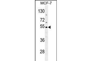 CES2 Antibody (Center) (ABIN654618 and ABIN2844316) western blot analysis in MCF-7 cell line lysates (35 μg/lane). (CES2 antibody  (AA 340-369))