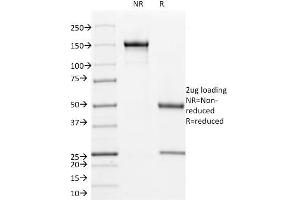 SDS-PAGE Analysis Purified CD171 Mouse Monoclonal Antibody (UJ127). (L1CAM antibody)