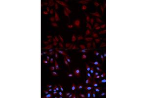Immunofluorescence analysis of HeLa cells using STAT5B antibody. (STAT5B antibody)
