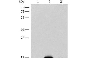 Western blot analysis of Mouse heart tissue Human heart tissue Human muscle tissue lysates using COX6A2 Polyclonal Antibody at dilution of 1:400 (COX6A2 antibody)