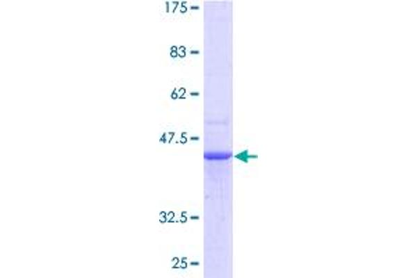 PDCD6 Protein (AA 1-191) (GST tag)