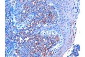 ABIN185362 (3µg/ml) staining of paraffin embedded Human Tonsil. (MYD88 antibody  (Internal Region))