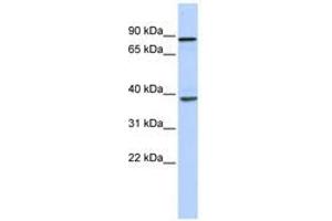 Image no. 1 for anti-DEAH (Asp-Glu-Ala-His) Box Polypeptide 35 (DHX35) (N-Term) antibody (ABIN6740494) (DHX35 antibody  (N-Term))