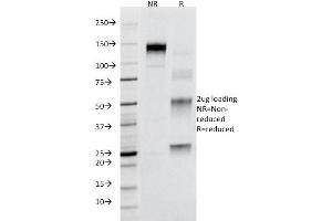 SDS-PAGE Analysis Purified CD95 Mouse Monoclonal Antibody (B-R18). (FAS antibody)