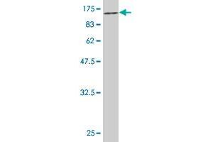 Western Blot detection against Immunogen (85. (CHEK2 antibody  (AA 1-543))