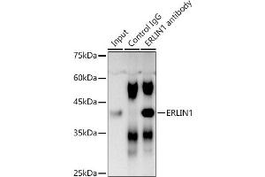 Immunoprecipitation analysis of 300 μg extracts of DU145 cells using 3 μg ERLIN1 antibody (ABIN7267005).