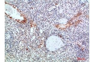 Immunohistochemical analysis of paraffin-embedded human-spleen, antibody was diluted at 1:200 (TICAM1 antibody  (AA 663-712))